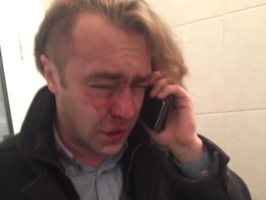 Свободовец Мирошниченко: Меня избил любовник бывшей жены