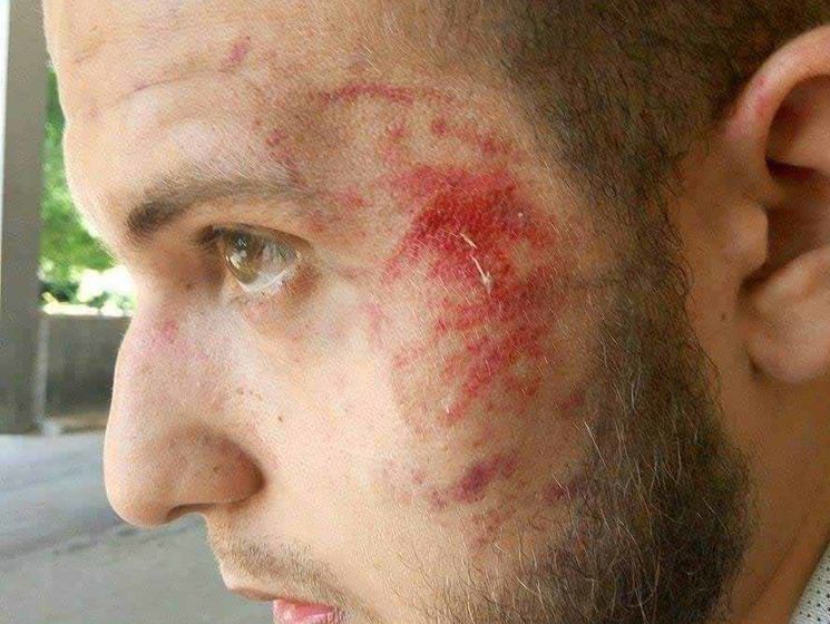 В Запорожье напали на журналиста "Громадського ТБ"