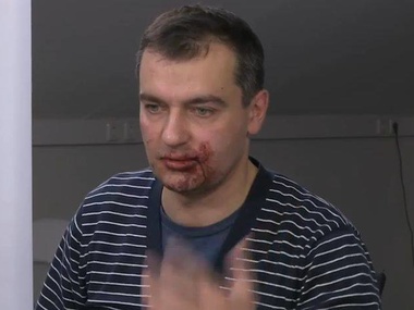 Милиция взялась за избиение киевских журналистов "титушками"