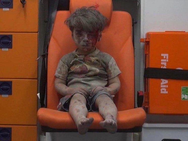 Кадры с пострадавшим во время авиаудара сирийским мальчиком облетели весь мир. Видео