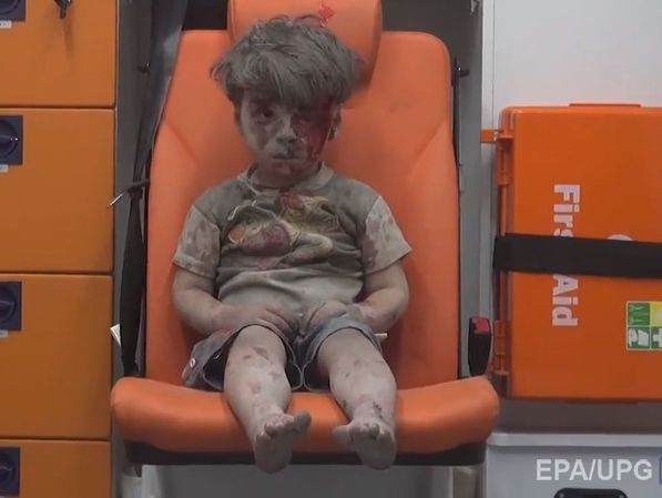 Умер брат сирийского мальчика, кадры с которым облетели мир после авиаудара по Алеппо