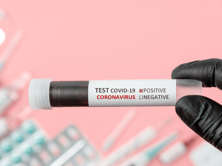 В семи областях и Киеве начали исследования на антитела к коронавирусу. Уже сделали 1355 тестов