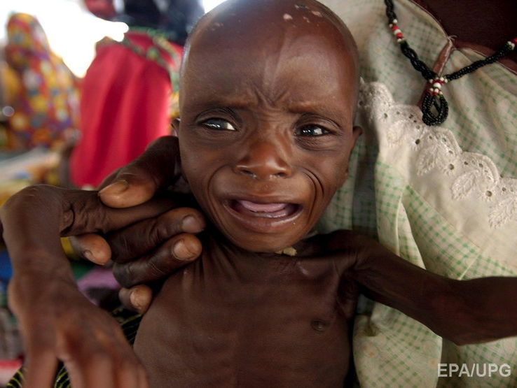 ООН: В Нигерии около 75 тысяч детей могут умереть от голода через несколько месяцев