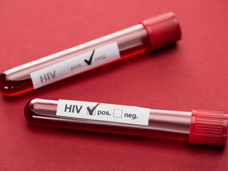 Верховная Рада внесла изменения в закон о профилактике и лечении ВИЧ-инфекции в соответствии с директивами ВОЗ