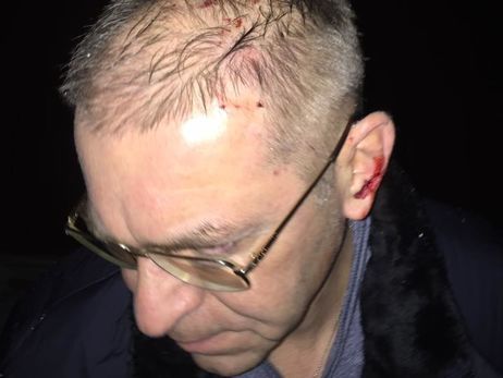 Раненный пулей Пашинского Химикус заявил, что не получает от нардепа помощи на лечение