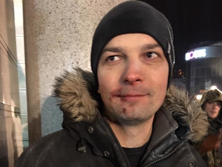 Егору Соболеву разбили лицо