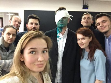 Навальный: Ни на секунду не сомневаюсь, что нападение на меня организовала администрация президента