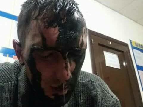 В Одесской области пытавшийся ночью закрасить герб Украины мужчина "перевернул ведро краски себе на голову"