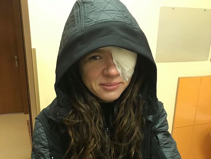 Руслана перенесла операцию на глазу