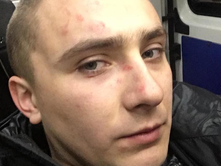 Экс-лидер одесского "Правого сектора" Стерненко сообщил, что Труханов организовал на него нападение