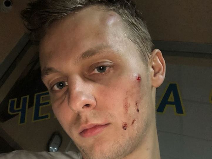 В киевском ресторане избили сына нардепа Шуфрича – пресс-служба политика