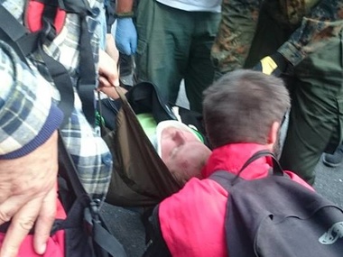 Во время столкновений под Верховной Радой милиция разбила мужчине голову
