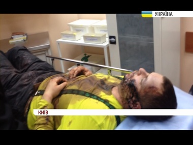 Кожара: Булатова не подвергали пыткам, у него только царапина на щеке