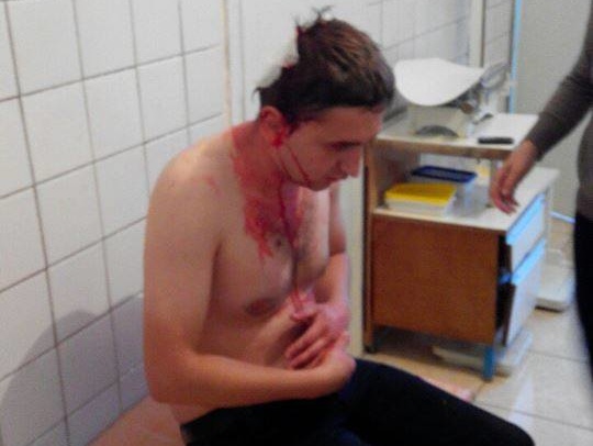 В Олевске избили арматурой борца с массовой нелегальной добычей янтаря, депутата Николайчука