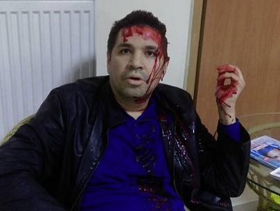 В Харькове неизвестный напал на кандидата в мэры Родзинского