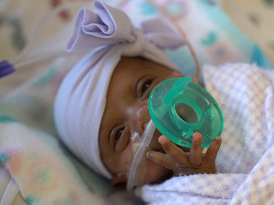 ﻿У США з лікарні виписали дівчинку Сейбі. Її вага під час народження становила 245 г