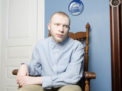 Американка представила коллекцию портретов альбиносов