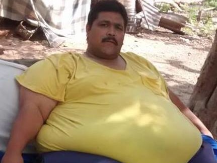 Самый толстый человек на Земле умер в Мексике в возрасте 38 лет 