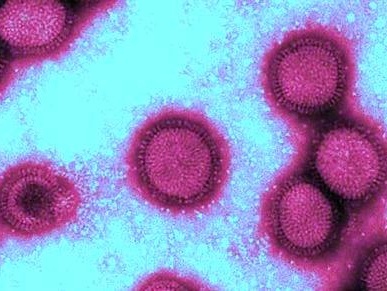 В Кировограде шесть человек заболели пандемическим гриппом
