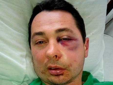 В Каховке избили депутата горсовета Хоминца