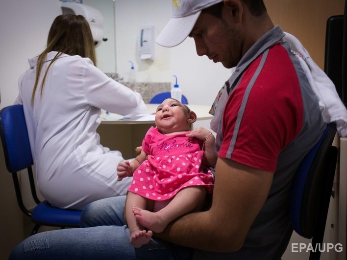 Минздрав Бразилии подтвердил более 400 случаев микроцефалии у новорожденных, 17 из которых связаны с вирусом Зика