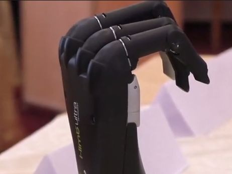В Украине впервые изготовили уникальный протез с сенсорными датчиками, которые реагируют на движение мышц