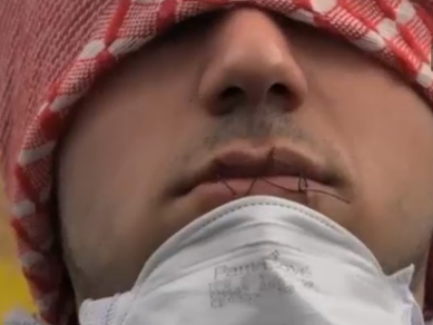 Во Франции мигранты зашили себе рты в знак протеста против сноса лагеря