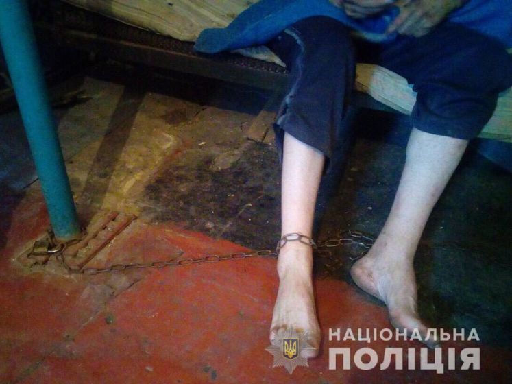 ﻿У Дніпропетровській області жінка тримала на ланцюгу дорослого сина – поліція
