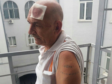 ﻿40 депутатів Європарламенту звернулися до Зеленського із проханням не віддавати Цемаха Росії