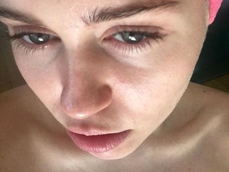 Лицо Сайрус до крови исцарапала кошка. Фото