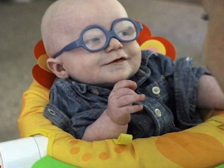 Мальчик-альбинос впервые отреагировал на свою маму