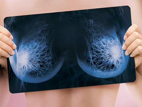 Маммологи настаивают на регулярном самообследовании