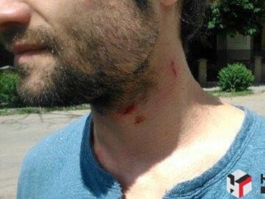 В Харькове напали на съемочную группу "Наші гроші", полиция открыла производство