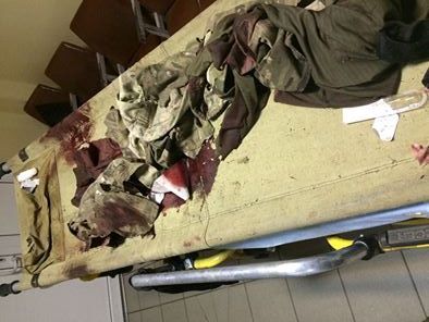 Волонтер Чмут: Даже через два года войны государство не способно обеспечить тепловизорами хотя бы линию столкновения