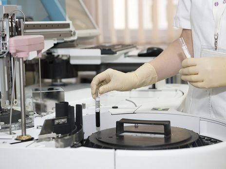 ﻿У Чернігові в лікарні залишаються 23 людини, хворі на гепатит А