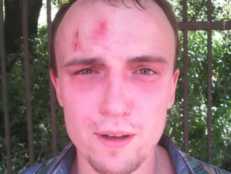 Мосийчук: Подозреваемые в убийстве Бузины получают в больнице медицинскую помощь