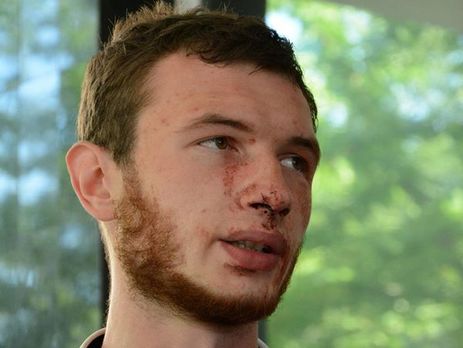 Полиция: После участия в следственных действиях по расследованию дела Бузины спецназовцам повредили автомобиль