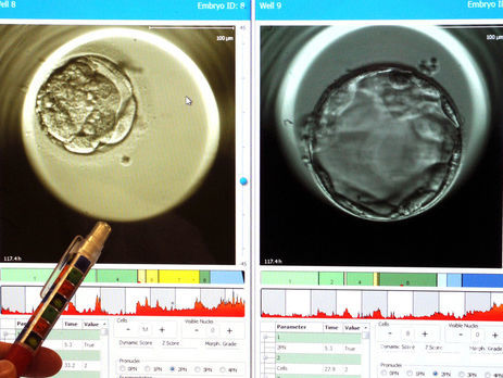 В этом году в Украине может впервые родиться ребенок от трех родителей