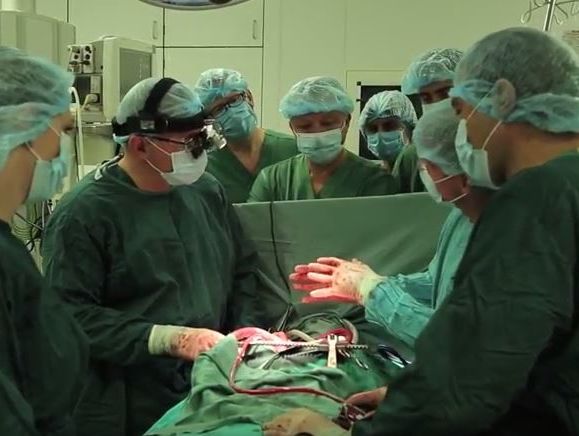 Кардиохирург Тодуров показал, как человеку впервые в Украине имплантировали механическое сердце. Видео