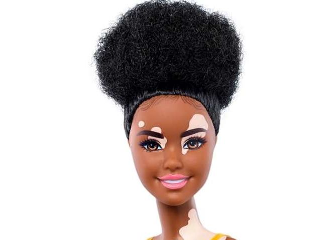 ﻿Mattel випустила Барбі з вітіліго, а також без волосся