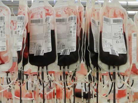 ﻿Приватні інвестиції в систему крові зупинять інфікування пацієнтів – експерти
