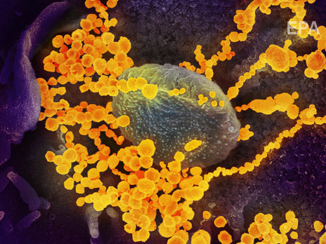 Атаку коронавируса SARS-CoV-2 на клетки человека сняли с помощью микроскопа