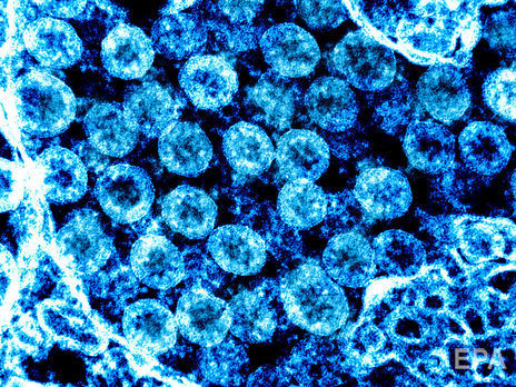 В Андорре подтвержден первый случай коронавирусной инфекции