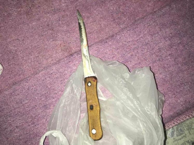 ﻿У Харківській області дівчинка завдала ножових поранень своїй бабусі – поліція