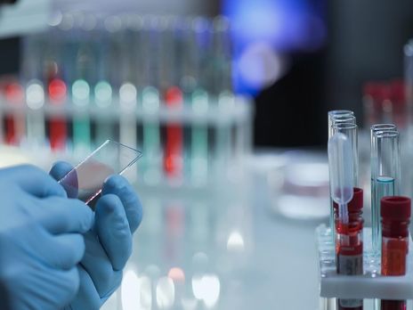 В Запорожье с подозрением на коронавирус госпитализировали женщину