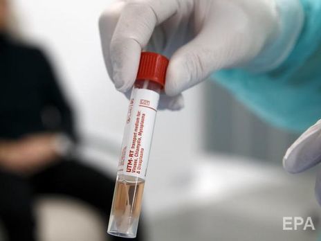 В Черновицкой области госпитализировали еще двух человек с подозрением на коронавирус