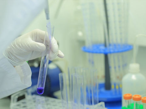 В Украине проверяют 44 подозрения на коронавирус