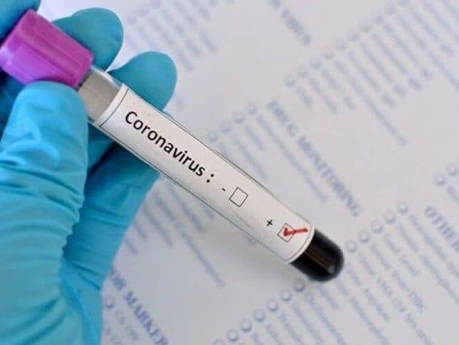 В Сумской области зафиксировали первый случай заражения коронавирусом