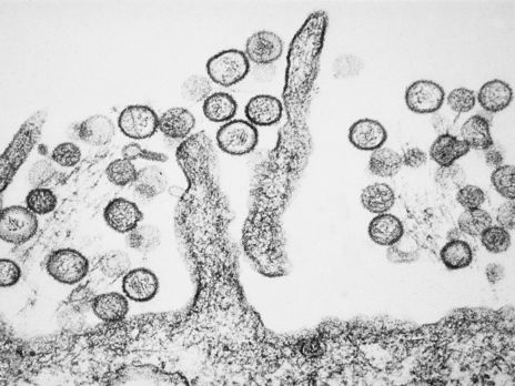 ﻿У Китаї чоловік помер від хантавірусу. Українська епідеміологиня запевнила, що цей вірус не зумовлює епідемій