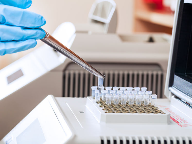 ﻿Наступного тижня в Україні можуть налагодити серійне виробництво тестів на коронавірус – МОЗ 